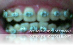 gigi (3)